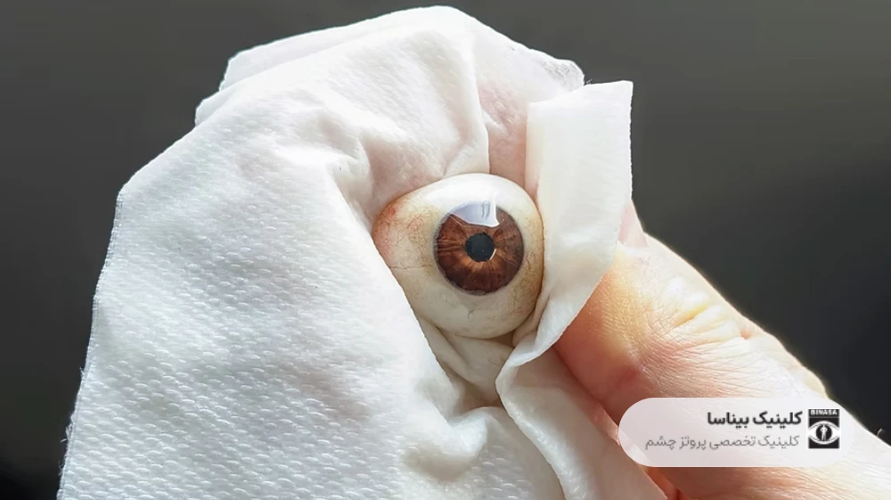 نکات مراقبتی پروتز چشم