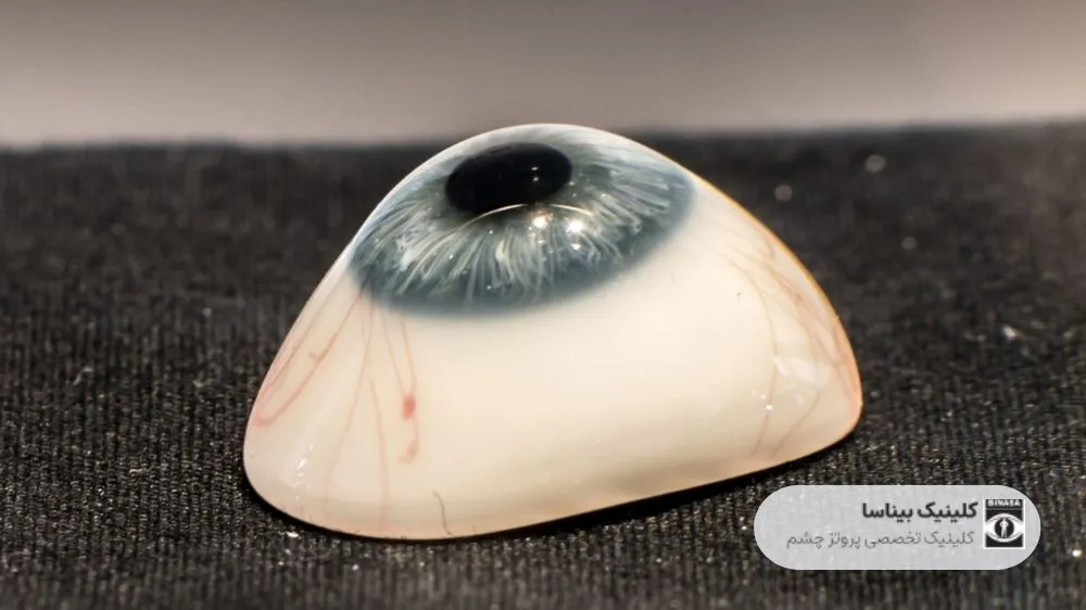 پروتز چشم بدون تخلیه