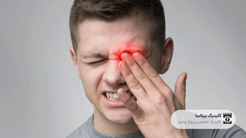 دلایل ایجاد ناراحتی در چشم دارای پروتز