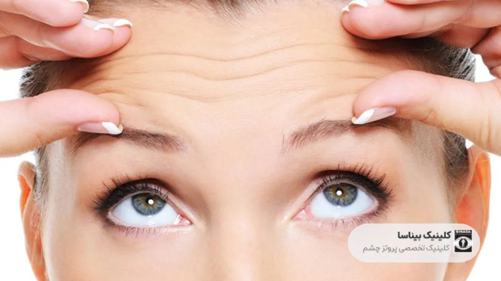 آیا چشم مصنوعی حرکت می کند؟