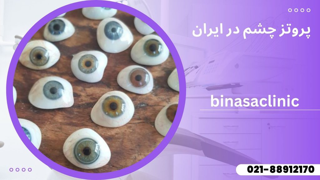 پروتز چشم در ایران