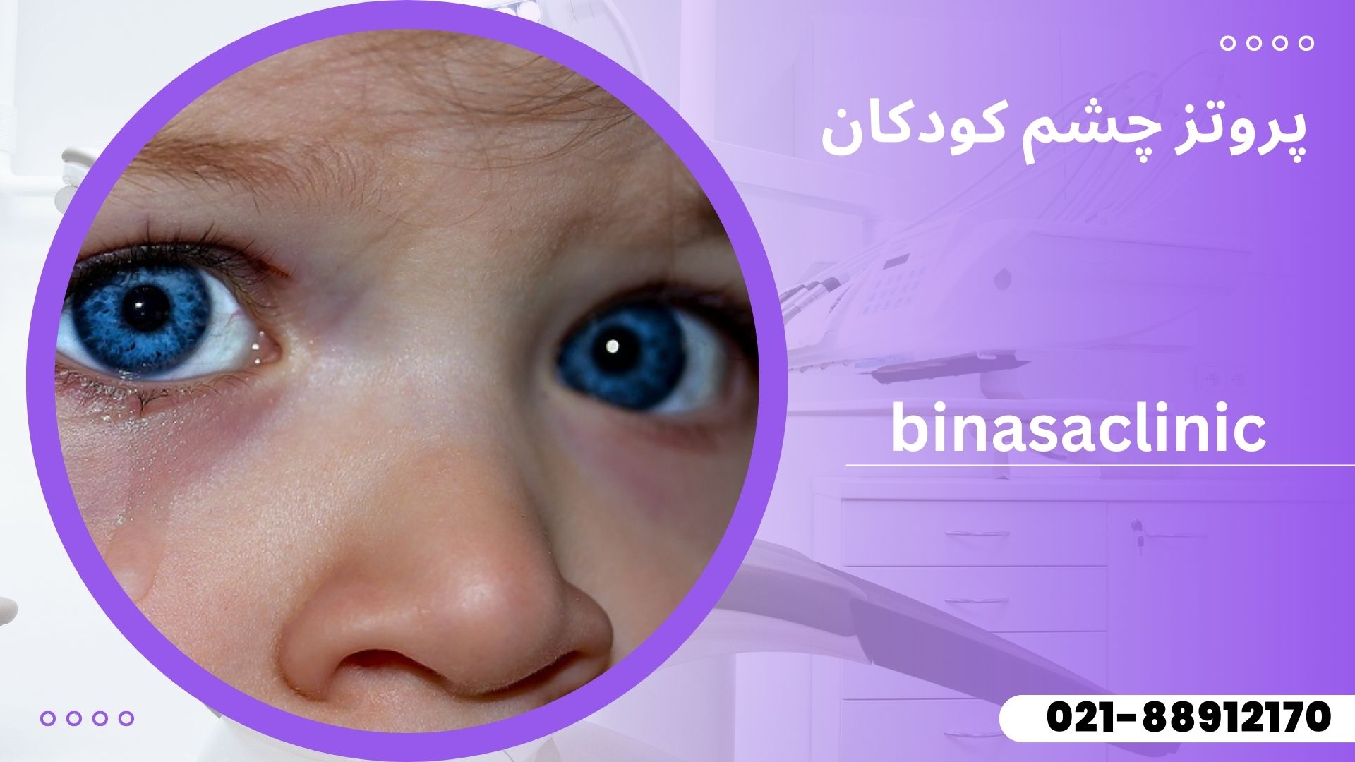 پروتز چشم کودکان در تهران با بهترین پزشک