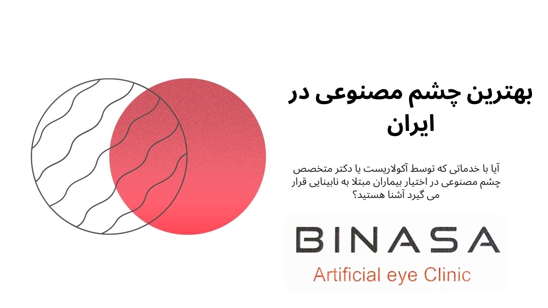 بهترین چشم مصنوعی در ایران