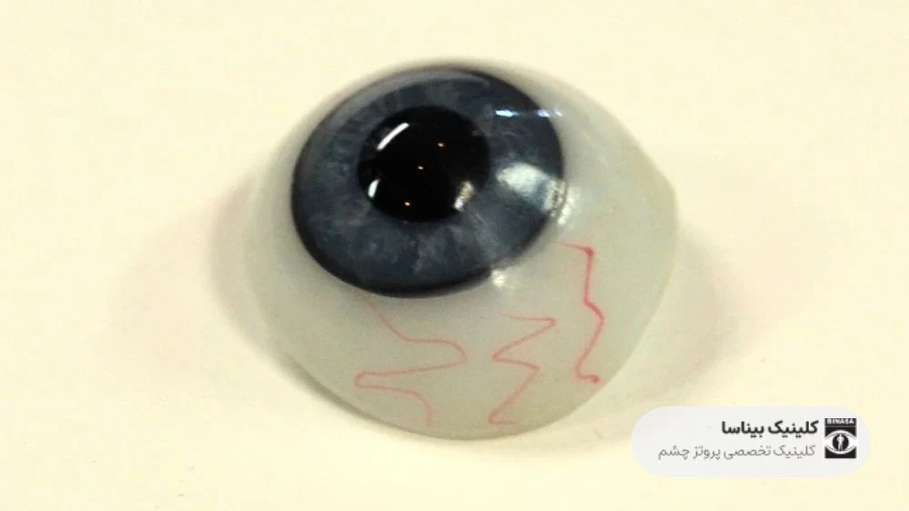 تاریخچه چشم مصنوعی