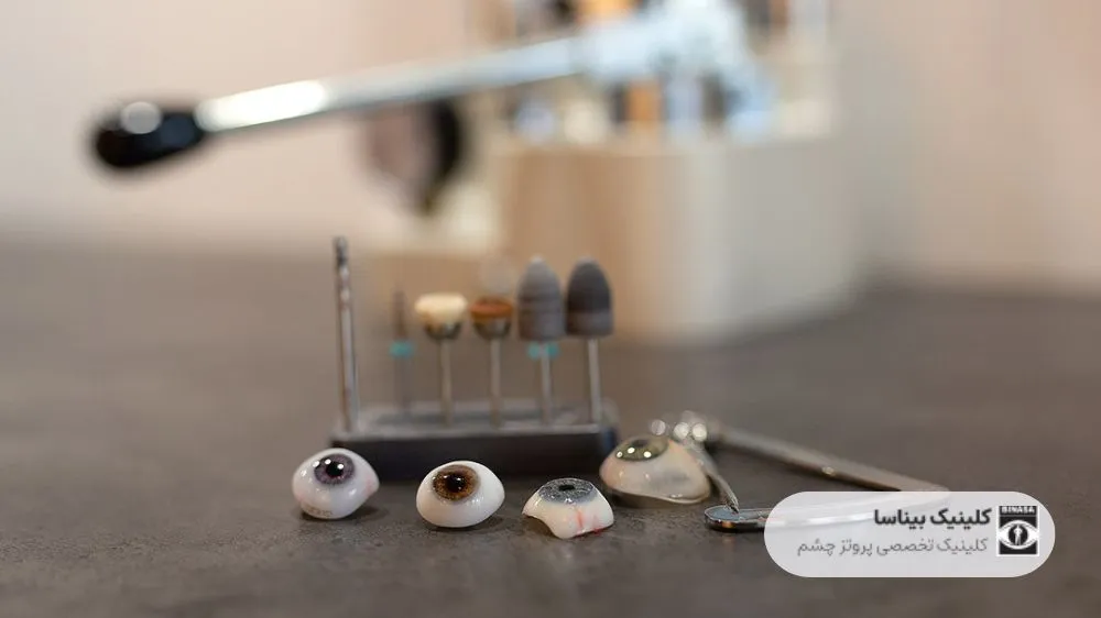 بهترین مرکز چشم مصنوعی