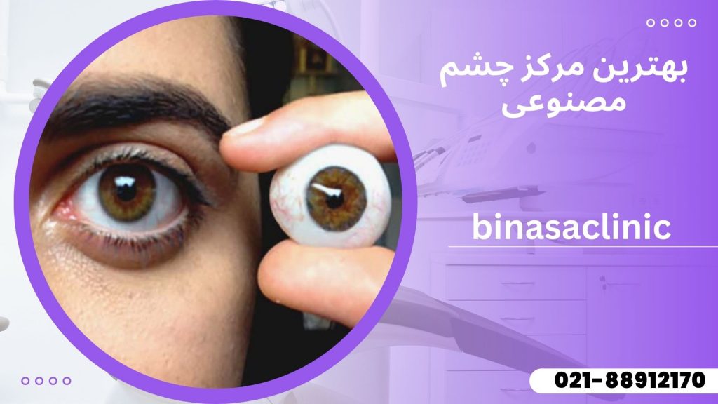 بهترین مرکز چشم مصنوعی در تهران
