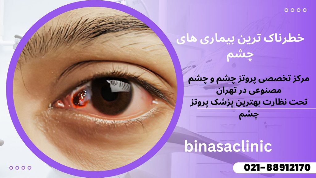 بیماری های چشمی که درمان ندارند
