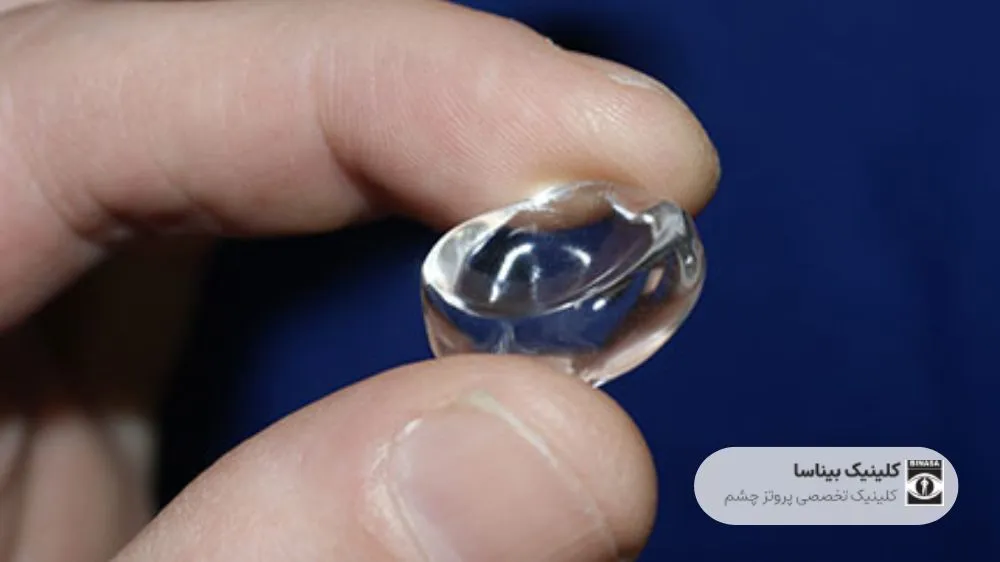 کانفورمر چشم چیست؟