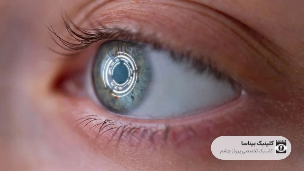 آیا چشم مصنوعی با قابلیت دید واقعی وجود دارد؟