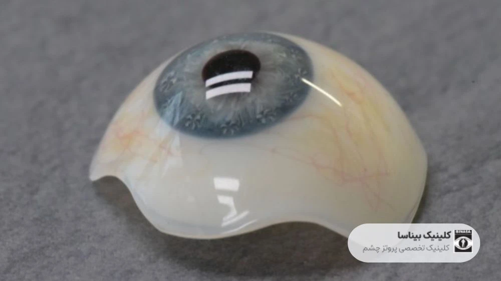 هر آنچه که باید در مورد چشم مصنوعی بدانید