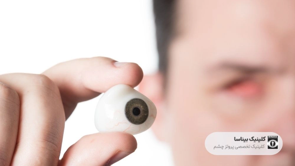 چه زمانی چشم نیاز به پروتز دارد؟