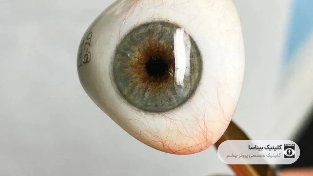 مراحل ساخت چشم مصنوعی