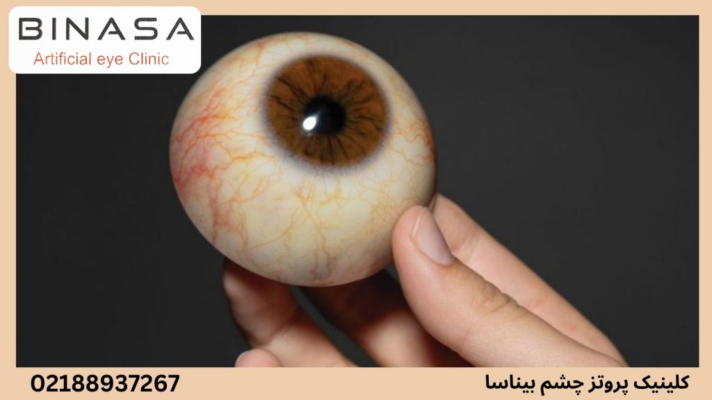 نکات مهم در استفاده از پروتز چشم