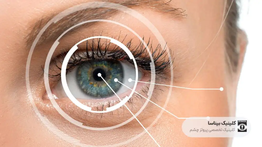 اجزای چشم انسان