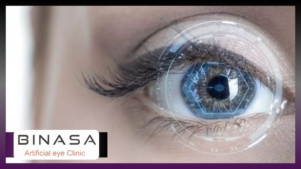 عمل لیزیک چشم چگونه انجام می شود؟