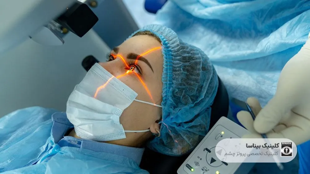 عمل لیزیک چشم چگونه انجام می شود؟