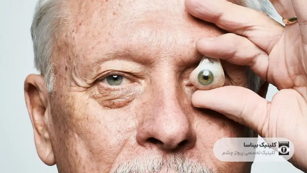 آیا با پروتز چشم می توان ورزش کرد؟