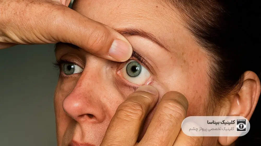 مراحل گذاشتن پروتز چشم