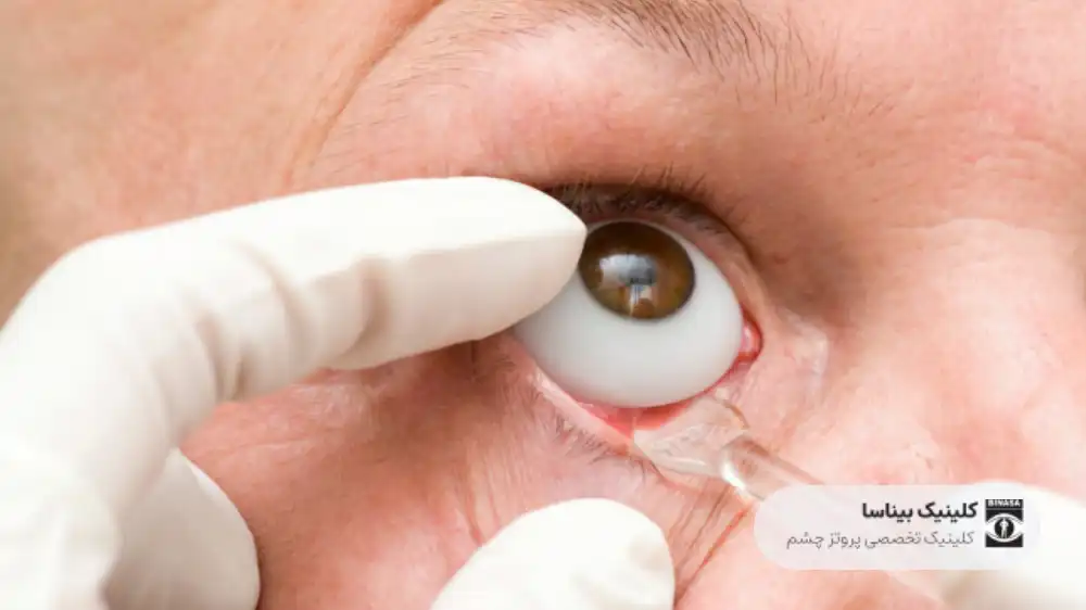 آیا استفاده از پروتز چشم دردناک است؟