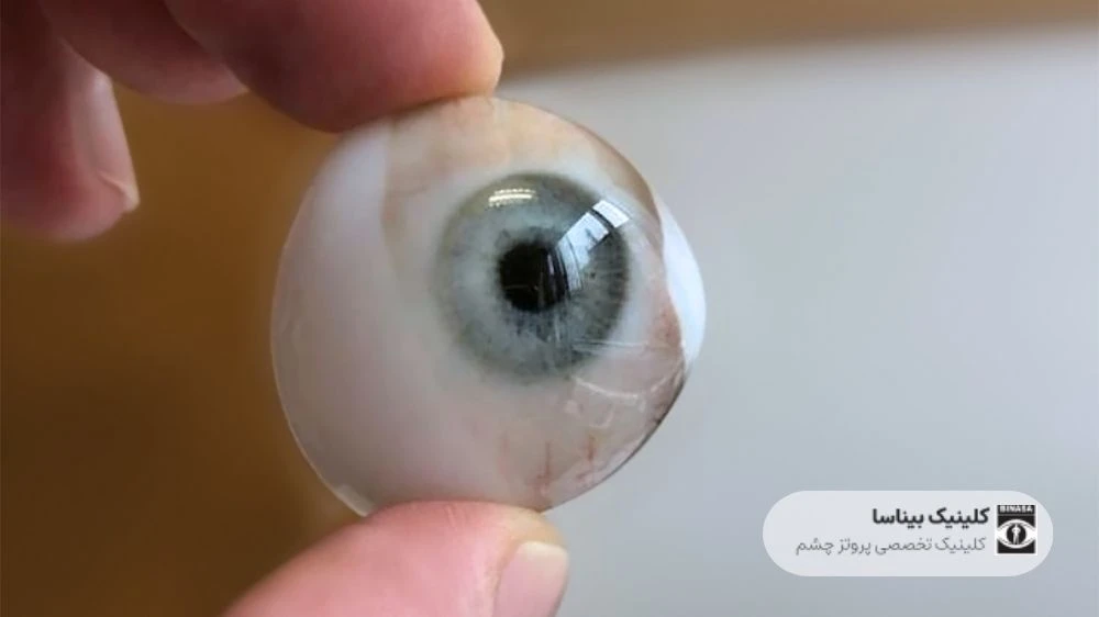 آیا پروتز چشم، شبیه چشم دیگر ساخته خواهدشد؟