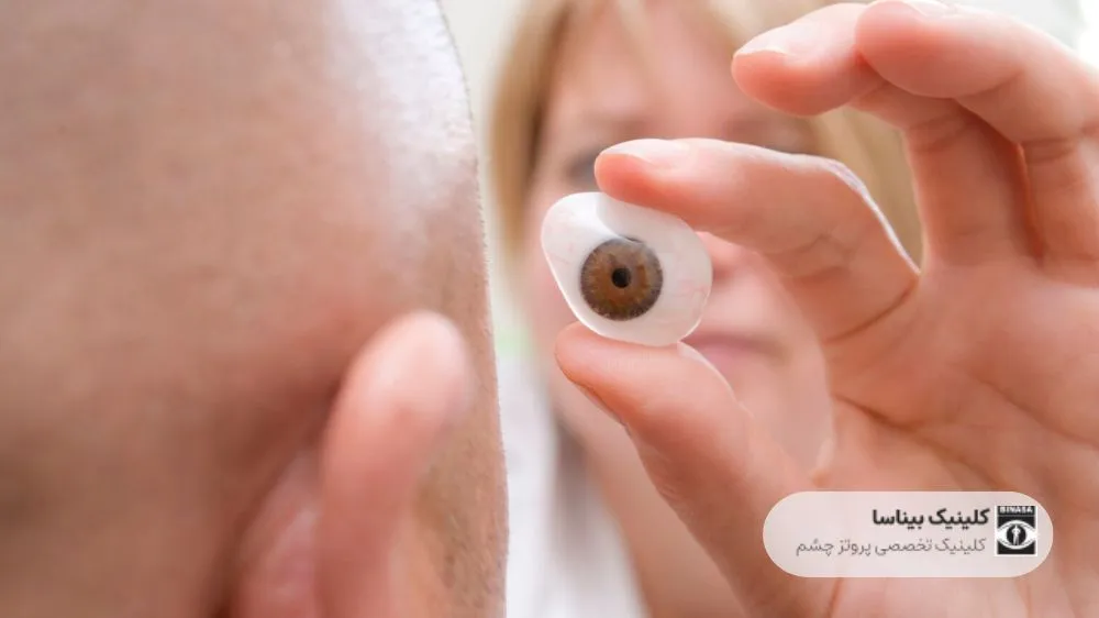 تجربیات افراد دارای چشم مصنوعی