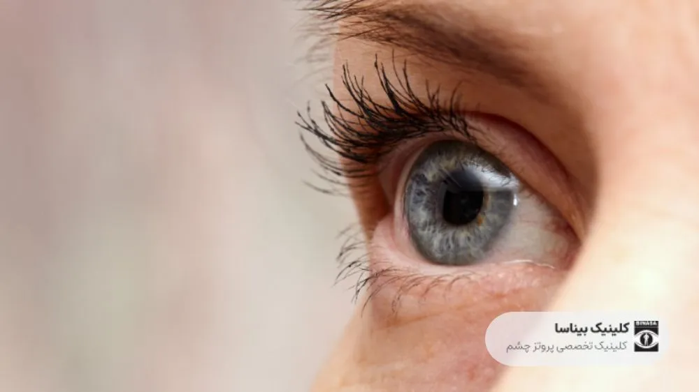 بازخورد حسی در چشم مصنوعی یا پروتز چشم