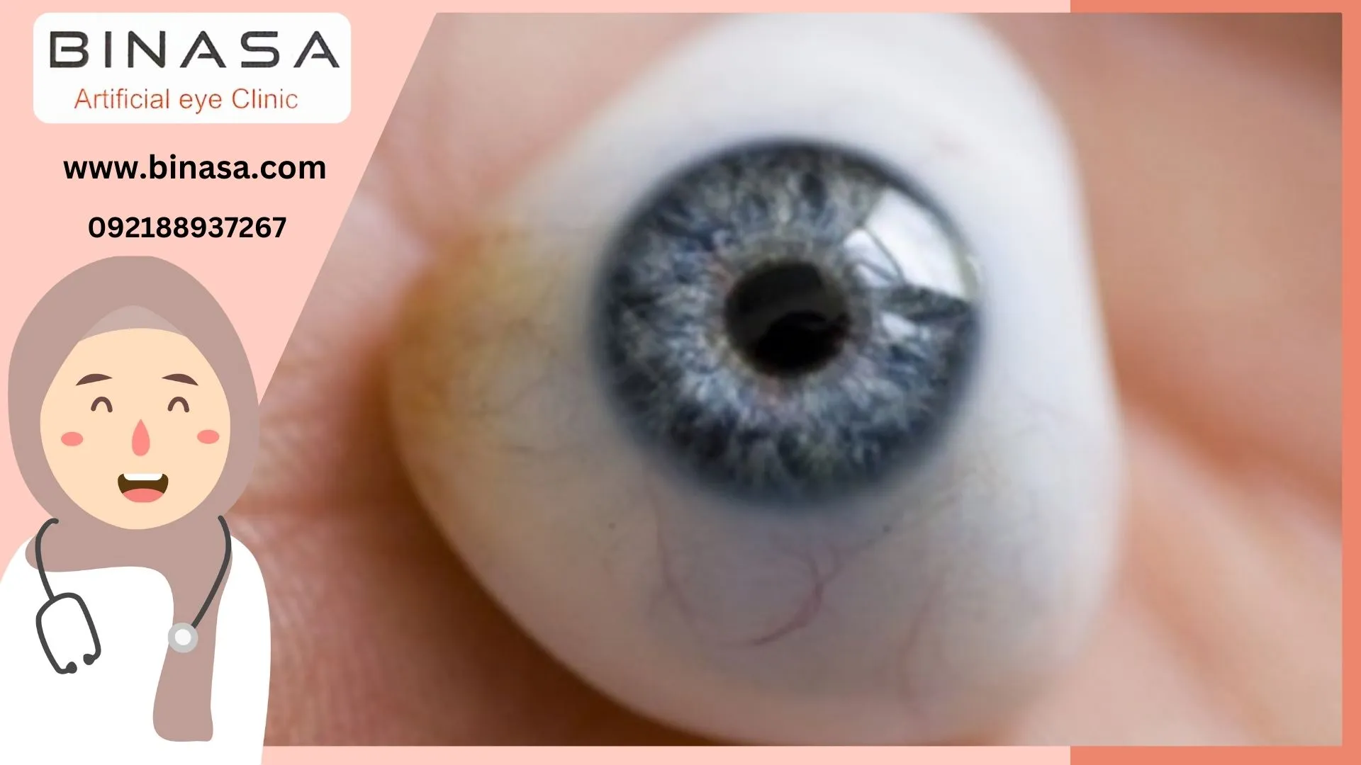 عوارض مراقبت نادرست از پروتز چشم