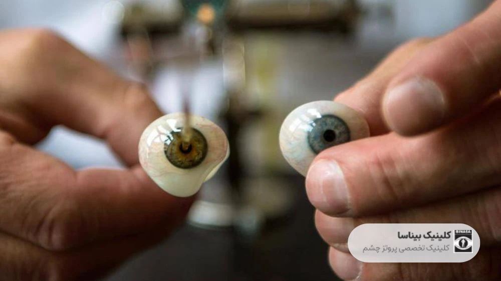 انواع پروتز چشم