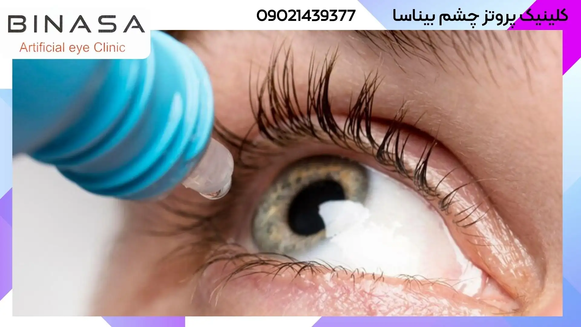 آیا می توان از هر جایی پروتز چشم تهیه کرد